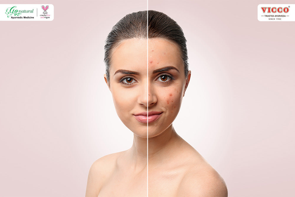 Make Healthy Changes in Lifestyle to Repair Damaged Skin