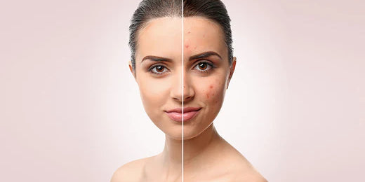 Make Healthy Changes in Lifestyle to Repair Damaged Skin